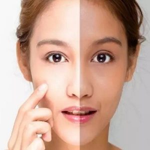 Unlocking the Youthful Glow with Skin Whitening Injections