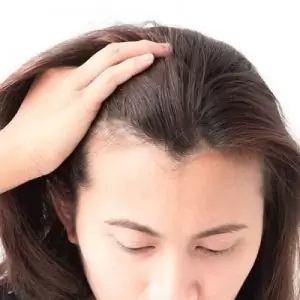 3 Things You Didn’t Know Were Making Women Go Bald | SKN Clinic