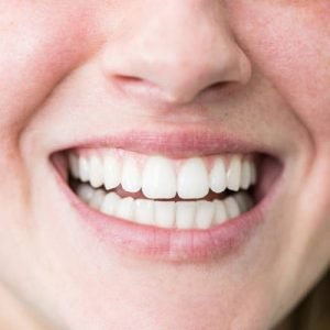 Is Hollywood smile treatment a good option for me?