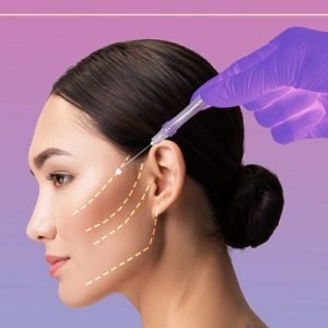 How long does the silhouette lift last?