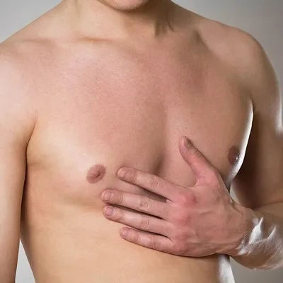 gynecomastia surgery cost in Islamabad