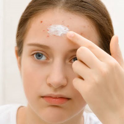 3 best female dermatologists for acne treatment in Islamabad