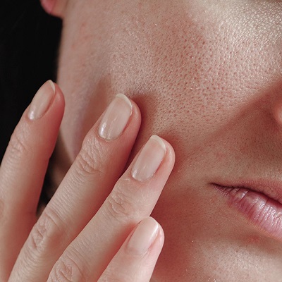 6 Dermatologist Approved Tips to Shrink Your Pores
