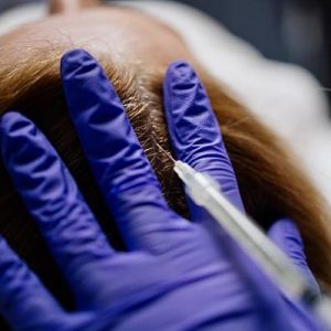 Can I see the results after one PRP?