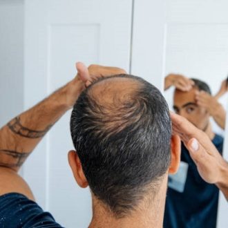 Can stress cause hair loss?