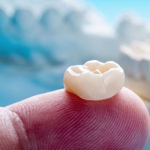 Smile design makeover cost in Islamabad