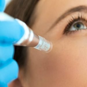 Microneedling Cost in Islamabad