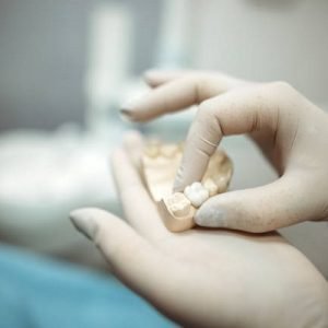 What is a dental implant and how it can help you?