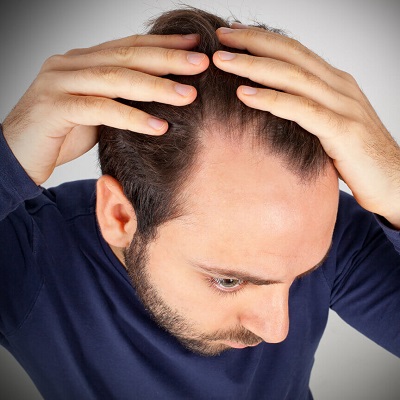 What is mesotherapy and how does it help with hair loss?