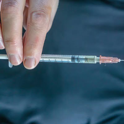 Does the doctor recommend P-shot injections for Erectile Dysfunction