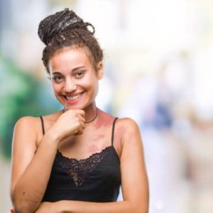 How do you permanently remove a birthmark?