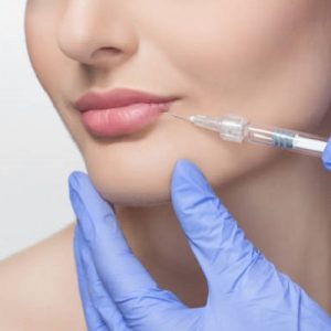How much do lip fillers cost?