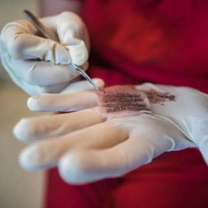 What precautions should I consider before and after hair transplant surgery?