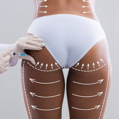 Which buttock lift treatment is the safest?