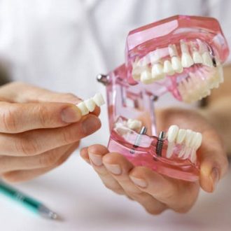 Which type of dental implant dentist recommends?