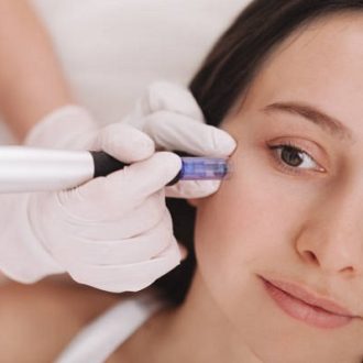 What are the dos and don’ts of microneedling?