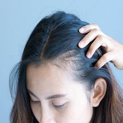 Does Medication Prescription For Hair Loss Work?