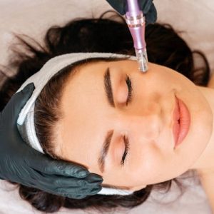 Best Dermatologist for Microneedling in Islamabad (Dr. Ayesha)