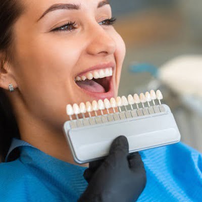 Full mouth dental veneers in islamabad Pakistan