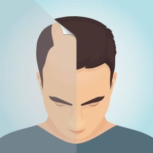 Good Hair transplant clinic in Islamabad