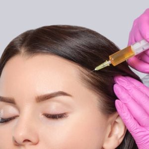 Platelet-Rich Plasma (PRP) Boost Hair Regrowth