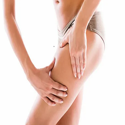 Which treatment works for cellulite removal? | cellulite treatment