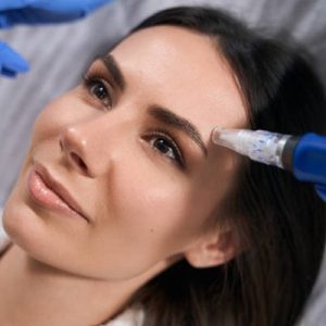 Microneedling pros & cons