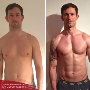 Results of Macrolane Injections