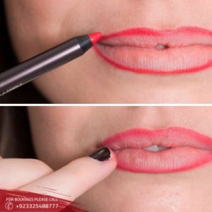 lip reducation before after