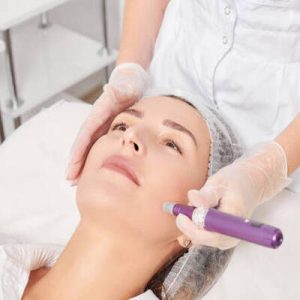 Microneedling Aftercare: Tips for Optimal Results