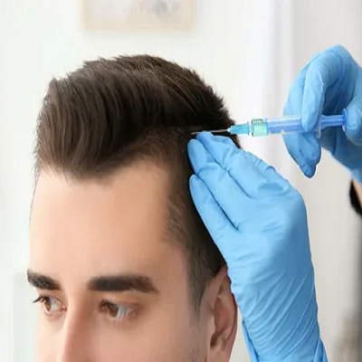 What happens after 1 year of Hair Transplant?