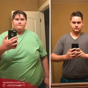 weight loss before after