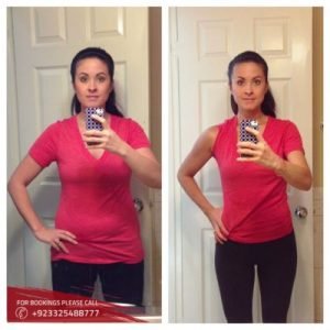 weight loss cost in Islamabad