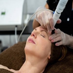 which laser treatments do celebrities often prefer to get?