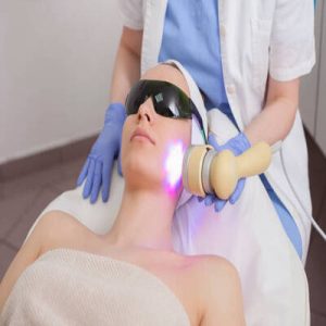 Laser Therapy for Acne Scars: Types and Effectiveness