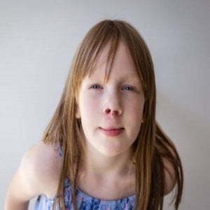 Early Detection and Intervention of cleft lip and palate