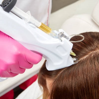 PRP Hair Treatment FAQs
