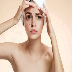 Is laser acne treatment safe for Teens?