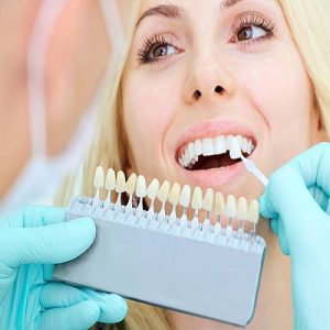 What is the duration required for teeth whitening strips to show results?