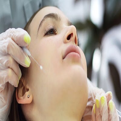 Thread Lift Pros & Cons
