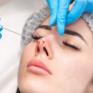 How to prepare for a nose tip-plasty?