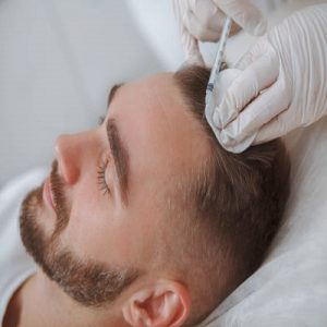 PRP for Different Types of Hair Loss: Tailored Solutions