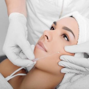 Step-by-Step Process of Getting a Thread Lift