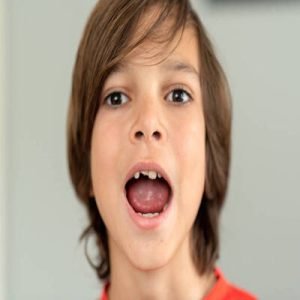 Fracture teeth treatment pros & cons