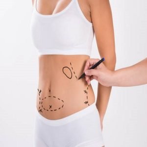 Tummy tuck pros & cons