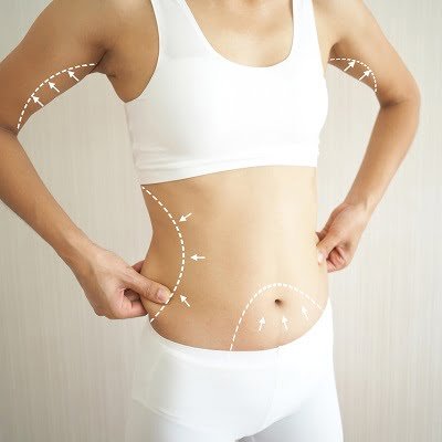 Fat Removal Surgery Cost in Pakistan | weight loss