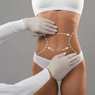 Liposuction Safety: What You Need to Know Before Going Under the Knife