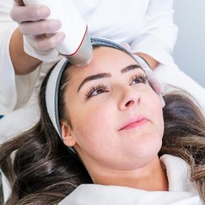 Microneedling for Large Pores: Myth or Miracle