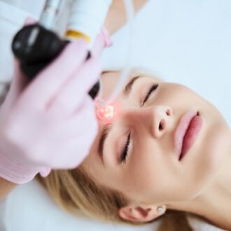 Is CO2 Laser Treatment Painful?