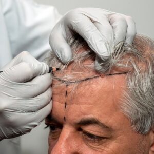 What is the Price of Hair Unit In Islamabad
